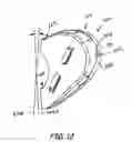 Fig. 08 - Support assembly for an ear