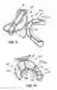 Fig. 09 - Support assembly for an ear