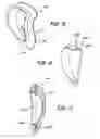 Fig. 10 - Support assembly for an ear