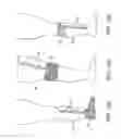 Fig. 09 - Graduated compression device having separate body and bands
