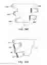 Fig. 15 - Graduated compression device having separate body and bands
