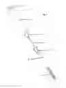 Fig. 02 - Locking Syringe System
