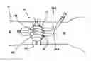 Fig. 01 - Device and method for the reduction of pain associated with needle sticks