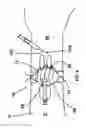 Fig. 07 - Device and method for the reduction of pain associated with needle sticks