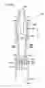 Fig. 35 - Subcutaneous infusion device and device for insertion of a cannula of an infusion device and method