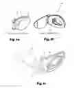 Fig. 02 - DEVICE FOR APPLYING AN OPHTHALMIC MEDICAMENT MIST