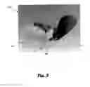 Fig. 04 - DEVICE FOR APPLYING AN OPHTHALMIC MEDICAMENT MIST