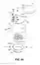 Fig. 12 - Controlled discharge ostomy appliance and shield therefor