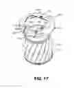 Fig. 13 - Controlled discharge ostomy appliance and shield therefor