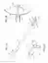 Fig. 04 - Indwelling urinary drainage catheter