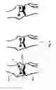 Fig. 09 - Adaptable therapeutic, diagnostic or surgical guide