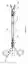 Fig. 23 - VACUUM COAGULATION & DISSECTION PROBES