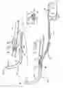 Fig. 03 - Surgical instrument with separate tool head and method of use