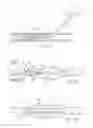 Fig. 06 - Surgical instruments for cutting cavities in intramedullary canals
