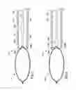 Fig. 03 - Self-orienting polypectomy snare device