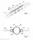 Fig. 05 - Self-orienting polypectomy snare device