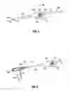 Fig. 05 - Surgical retrieval apparatus for thoracic procedures