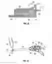 Fig. 09 - Surgical retrieval apparatus for thoracic procedures