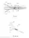 Fig. 02 - Single Stage hemostasis clipping device