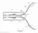 Fig. 35 - Single Stage hemostasis clipping device