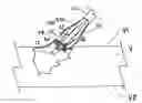 Fig. 01 - Vessel closure device