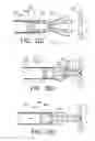 Fig. 15 - Vessel closure device
