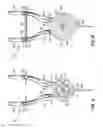 Fig. 05 - Medical devices for suturing biological tissue