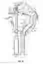 Fig. 10 - Medical devices for suturing biological tissue