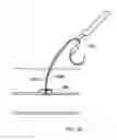 Fig. 13 - Suturing device for sealing a puncture in an anatomical structure