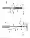 Fig. 14 - Suturing device for sealing a puncture in an anatomical structure