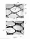 Fig. 03 - APPARATUS AND METHOD FOR LIMITING SURGICAL ADHESIONS