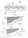 Fig. 05 - APPARATUS AND METHOD FOR LIMITING SURGICAL ADHESIONS