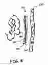 Fig. 07 - APPARATUS AND METHOD FOR LIMITING SURGICAL ADHESIONS