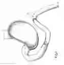 Fig. 02 - EQUIPMENT TO APPROXIMATE TISSUE PORTIONS, WHICH ARE INTENED TO FORM AN ANASTOMOSIS, AND A METHOD FOR PERFORMING ANASTOMOSES IN TRACTS OF THE DIGESTIVE TUBE
