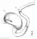 Fig. 03 - EQUIPMENT TO APPROXIMATE TISSUE PORTIONS, WHICH ARE INTENED TO FORM AN ANASTOMOSIS, AND A METHOD FOR PERFORMING ANASTOMOSES IN TRACTS OF THE DIGESTIVE TUBE