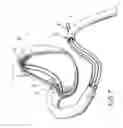Fig. 08 - EQUIPMENT TO APPROXIMATE TISSUE PORTIONS, WHICH ARE INTENED TO FORM AN ANASTOMOSIS, AND A METHOD FOR PERFORMING ANASTOMOSES IN TRACTS OF THE DIGESTIVE TUBE