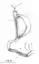Fig. 09 - EQUIPMENT TO APPROXIMATE TISSUE PORTIONS, WHICH ARE INTENED TO FORM AN ANASTOMOSIS, AND A METHOD FOR PERFORMING ANASTOMOSES IN TRACTS OF THE DIGESTIVE TUBE