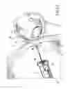 Fig. 28 - EQUIPMENT TO APPROXIMATE TISSUE PORTIONS, WHICH ARE INTENED TO FORM AN ANASTOMOSIS, AND A METHOD FOR PERFORMING ANASTOMOSES IN TRACTS OF THE DIGESTIVE TUBE