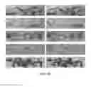 Fig. 23 - METHOD OF EVALUATING A TREATMENT FOR VASCULAR DISEASE