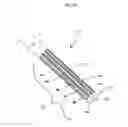 Fig. 03 - Disc nucleus removal devices and methods