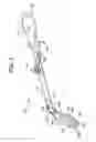Fig. 05 - Disc nucleus removal devices and methods