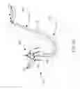 Fig. 07 - HEART VALVE REMODELING