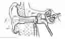 Fig. 01 - Stabilization system and aspiration device with protected cutting edge