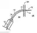Fig. 01 - Transseptal puncture apparatus