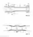 Fig. 07 - Occluder