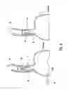 Fig. 06 - INJECTABLE IMPLANTS FOR TISSUE AUGMENTATION AND RESTORATION