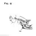 Fig. 08 - INJECTABLE IMPLANTS FOR TISSUE AUGMENTATION AND RESTORATION