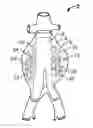 Fig. 01 - Embolization device and a method of using the same