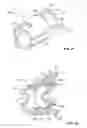 Fig. 13 - Embolization device and a method of using the same