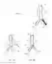 Fig. 05 - Intraluminal polymeric devices for the treatment of aneurysms